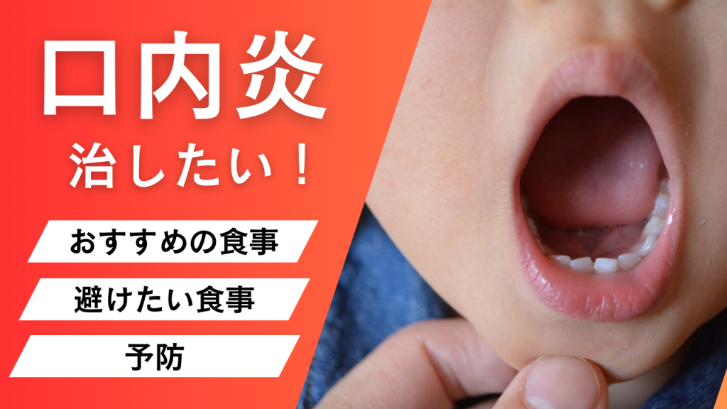 口内炎を治したい！｜おすすめの食事・避けたい食事・予防するには？